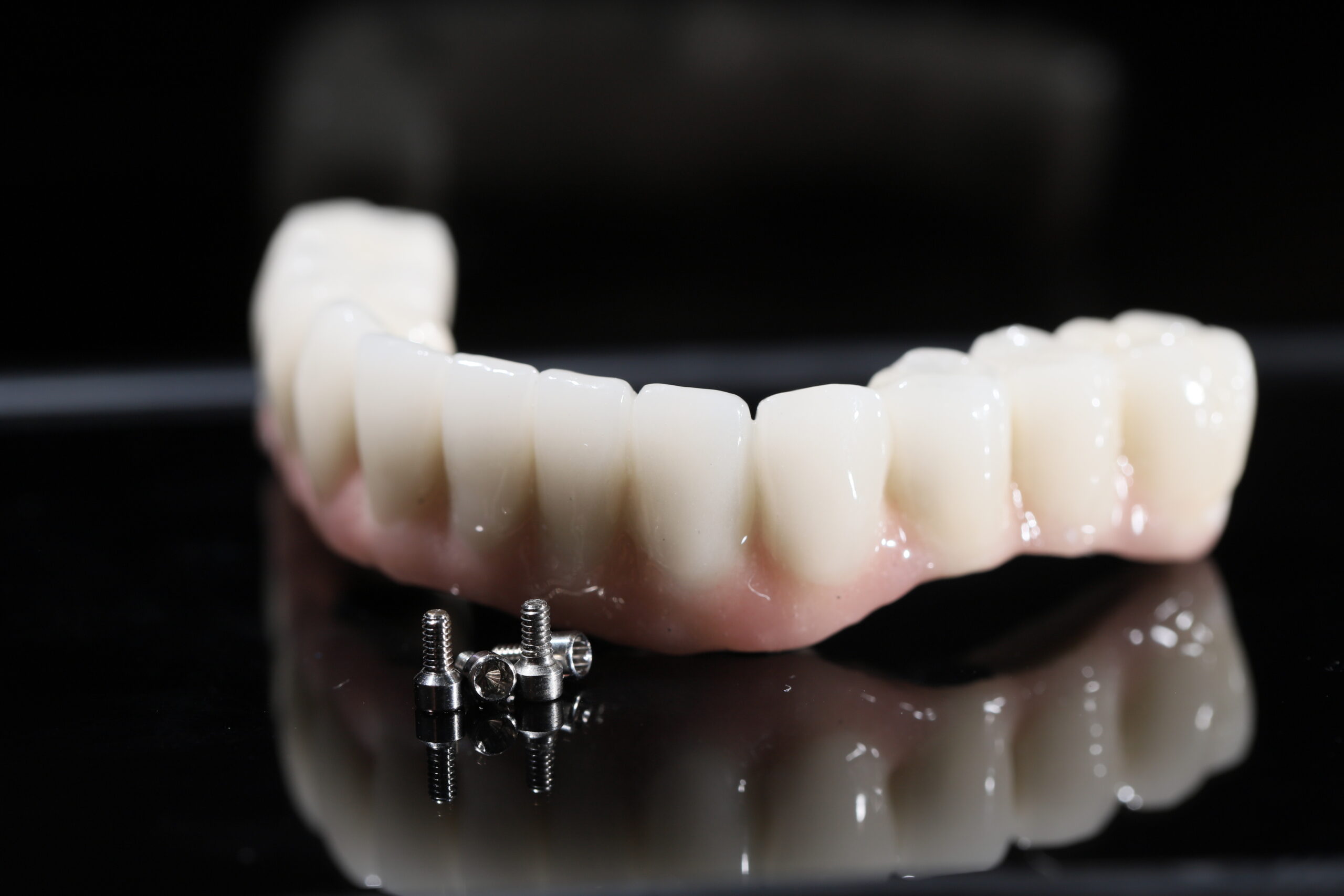 The All-on-4, All-on-X, and All-on-4 treatment concepts in dental implant therapy provide full arch dental prosthesis for completely edentulous jaws. Dental implants are a dentistry treatment placed