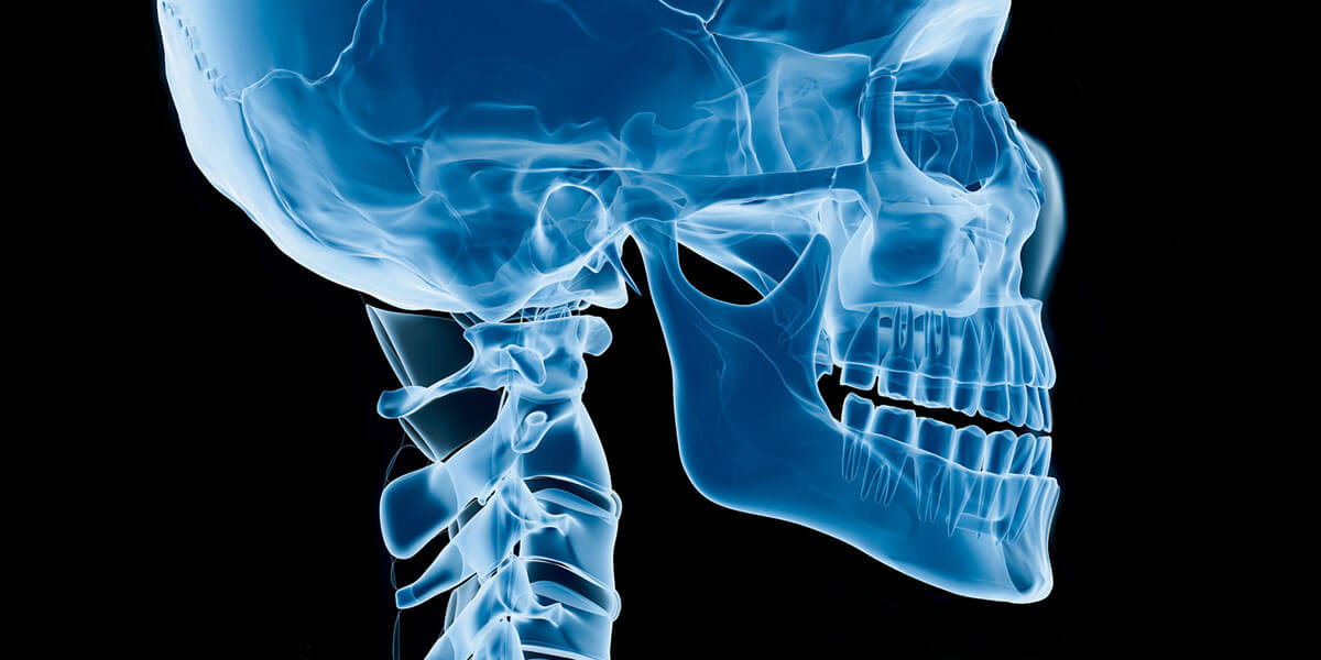 Orthognathic Surgery | Greenwich Oral & Maxillofacial Surgery Associates